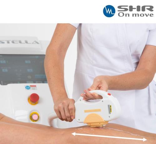 EPILATIONS Lumiére Pulsée IPL